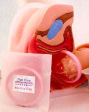 SAMPLE Intimate Disc (Trial 1)